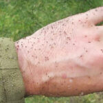 Febre do Oropouche a doença do maruim foi confirma em três cidades catarinense Febre do Oropouche a doença do maruim foi confirma em três cidades catarinense